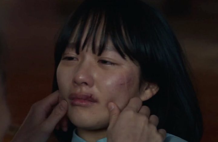 比《黑暗荣耀》更可怕的“釜山女中霸凌事件”！烟蒂烫皮、后脑勺破洞，加害者竟被轻判-12