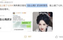 30岁女星武训意外受伤，缝了7针，撞脸李若彤！缩略图
