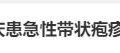 蔡国庆忍痛录节目，疱疹痛不倒他缩略图