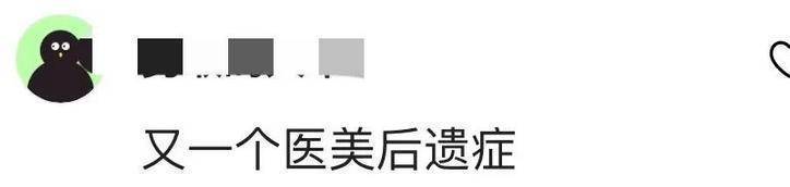 49岁林心如大变样，脸肿酒窝消失，网友惊呼：医美后遗症太明显了