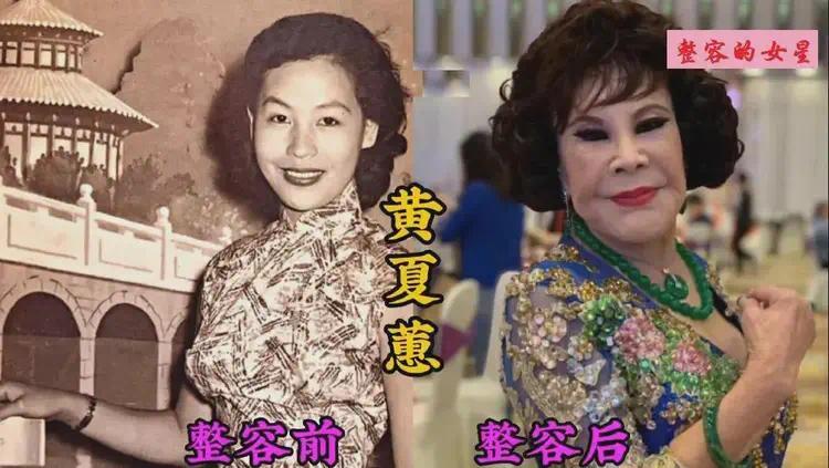聊聊整容失败的女星，你觉得谁最让人惋惜？