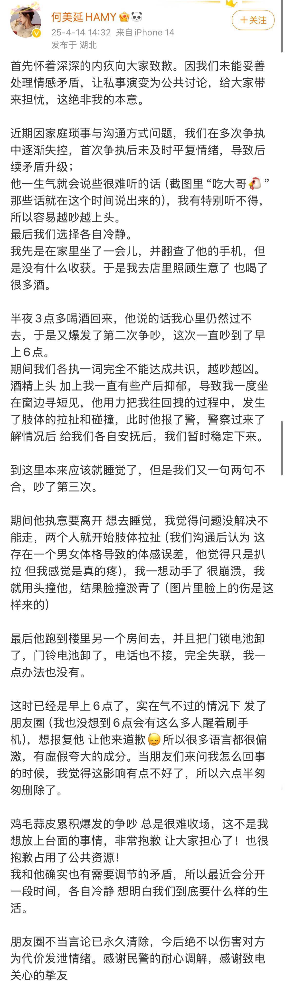 何美延爆料老公家暴，差点把我掐到喘不过气来
