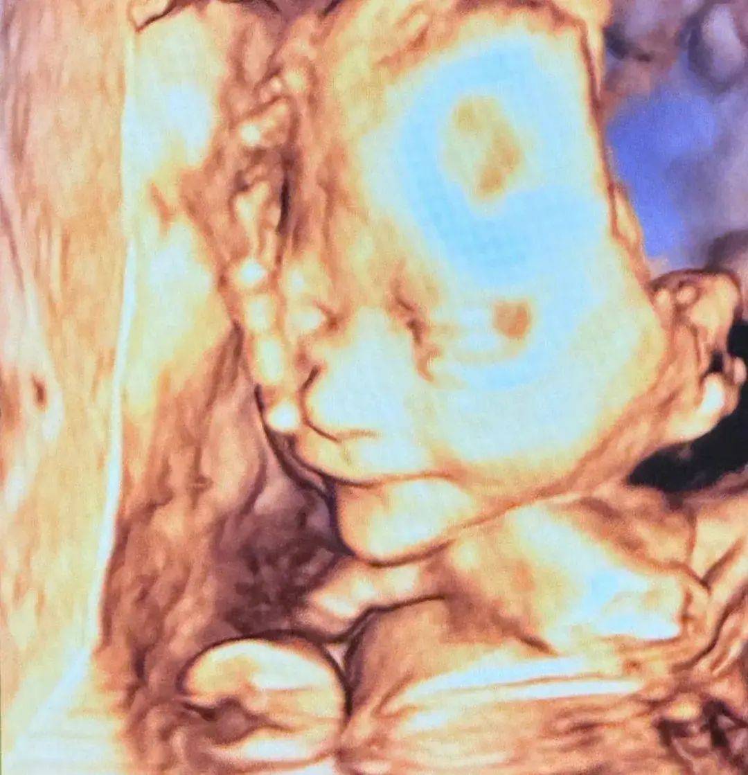 包文婧快生了还这么潮，打扮得像个小姑娘，又酷又年轻！二胎名字也太可爱了吧！